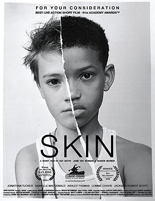 Skin